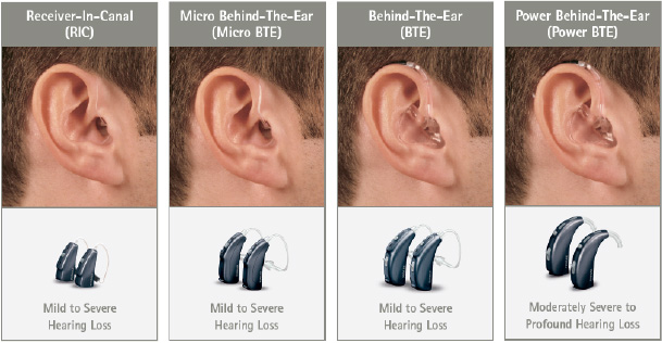 6 tipos de auriculares internos y externos - ¡Nombres, fotos y