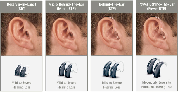 Types of hearing aids: What's best for you?